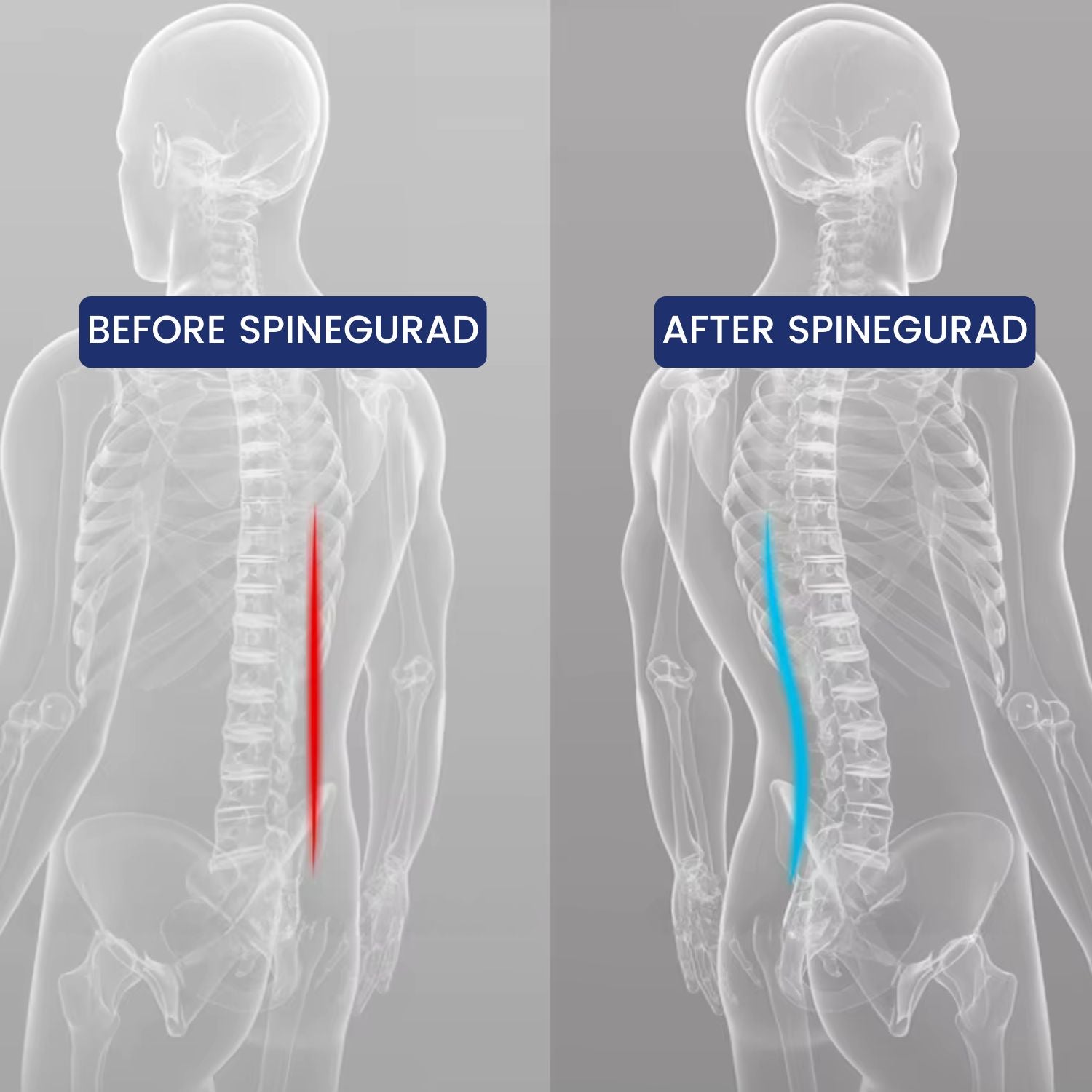 Before_After_SpineGuard